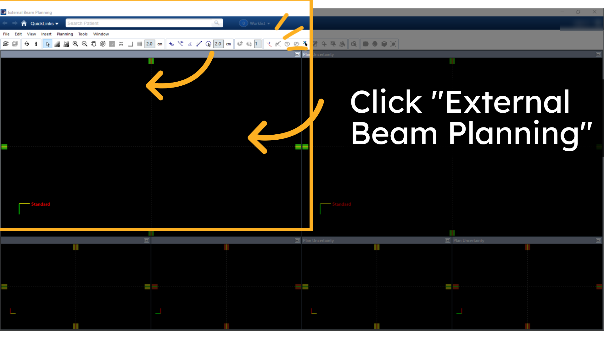 Click 'External Beam Planning'