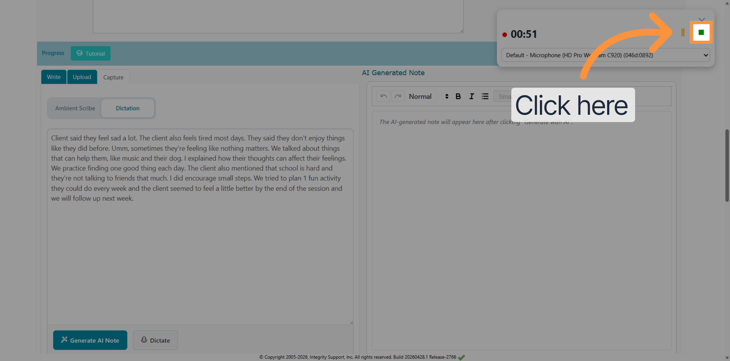 Advance Editing Options