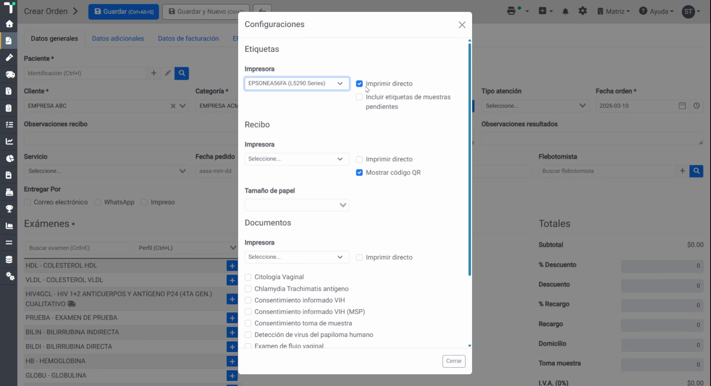 Configurar impresión directa
