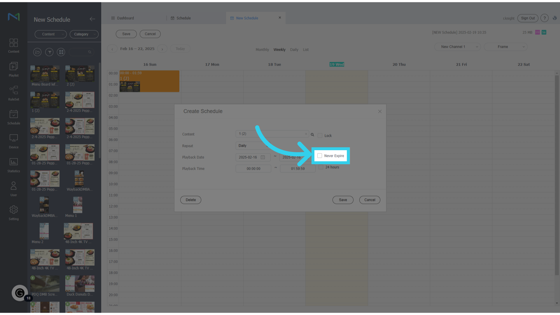 Or we can click 'Never Expire' for permanent content