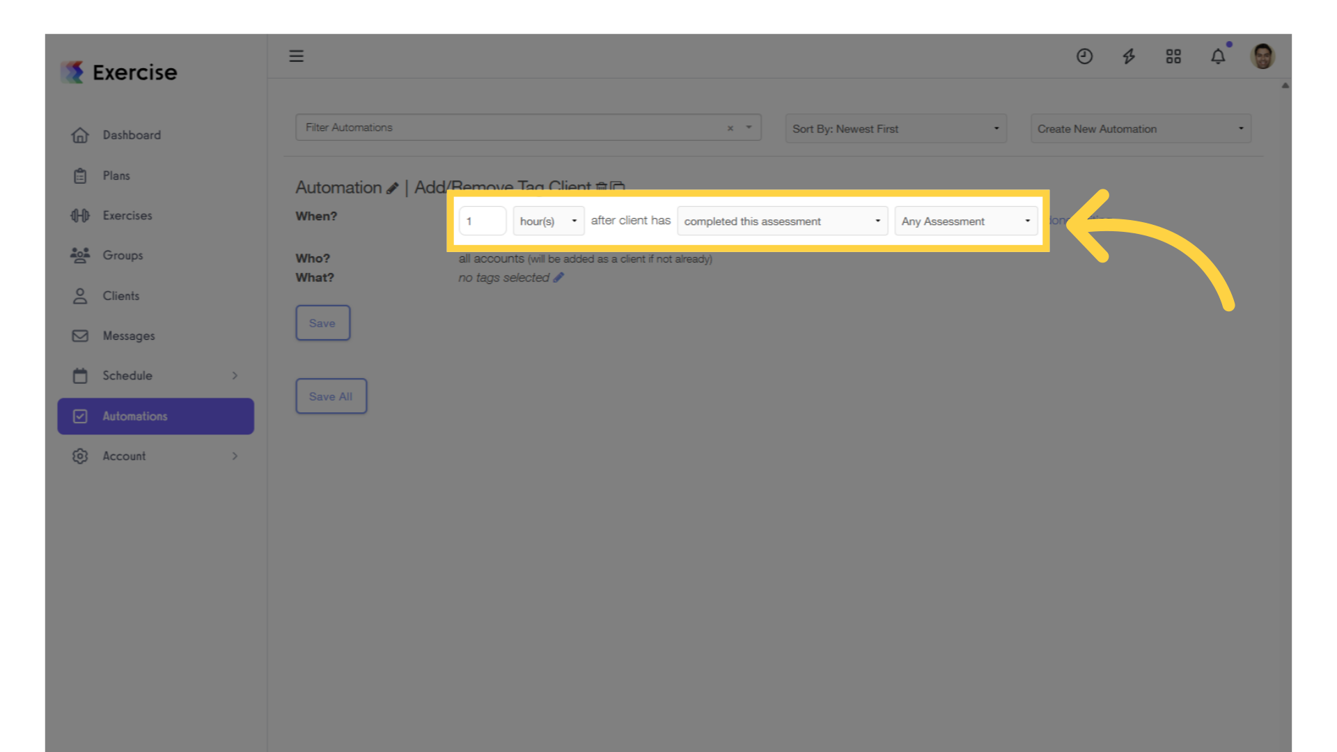 Customize the settings.