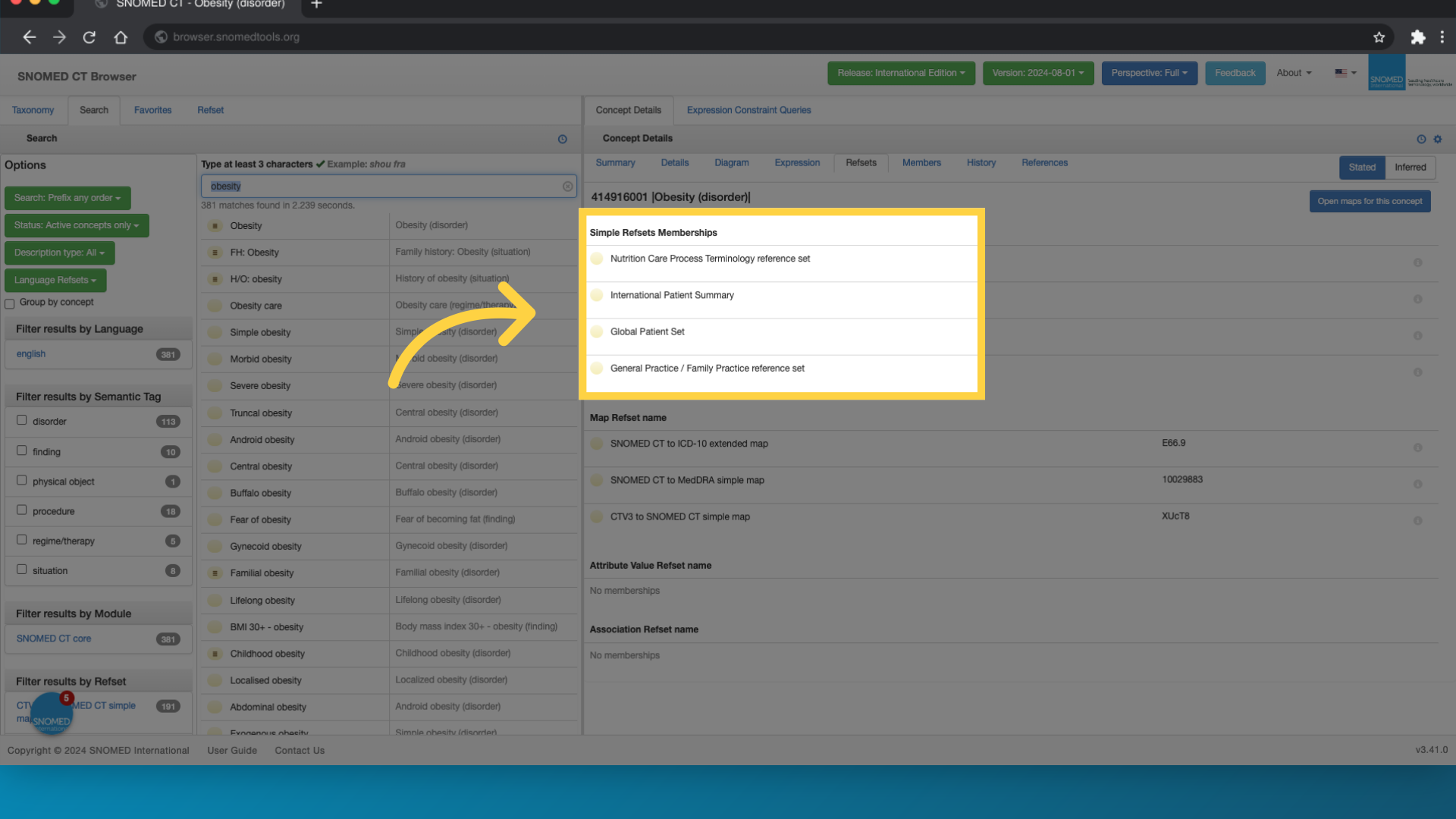 View simple type reference sets