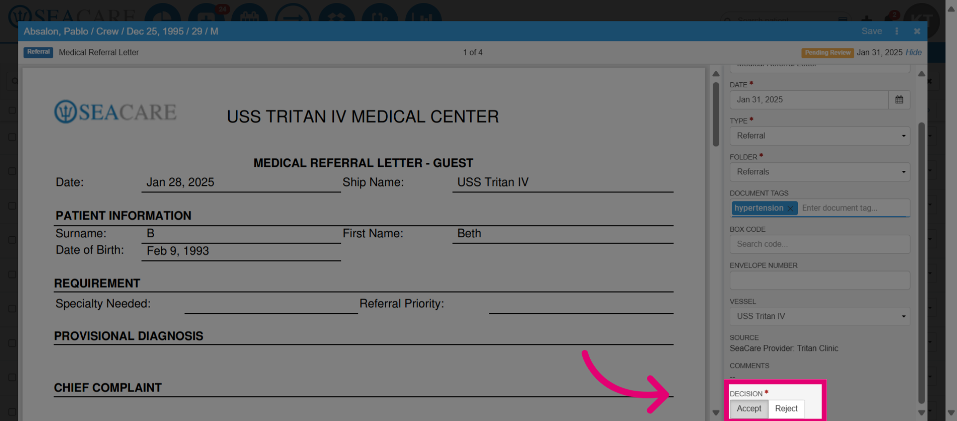 Select 'Accept'